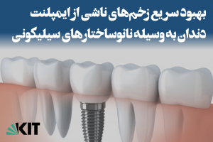 بهبود سریع زخم‌های ناشی از ایمپلنت دندان به وسیله نانوساختارهای سیلیکونی